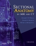 Sectional Anatomy by MRI and CT "with Website"
