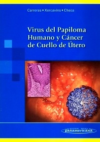 Virus Del Papiloma Humano Y Cáncer De Cuello de Útero