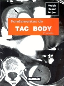 Fundamentos De TAC Body