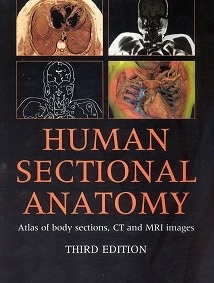 Human Sectional Anatomy "Atlas of Body Sections, CT and MRI Images"