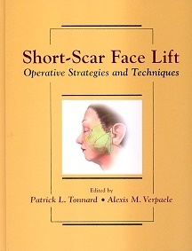 Short-Scar Face Lift "Operative Strategies and Techniques"