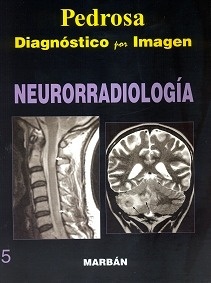 Diagnostico por Imagen Neurorradiologia Vol. 5 "Flexilibro"