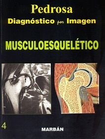 Diagnostico por Imagen Musculoesqueletico Vol. 4 "Flexilibro"
