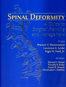 Spinal Deformity "A Guide To Sugical Planing And Management"