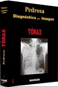 Diagnostico por Imagen. Torax. Vol. 1