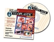 Atlas of Oculoplastic Surgery on CD-ROM