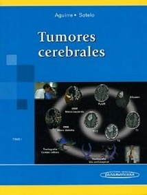 Tumores Cerebrales Tomo 1