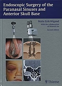Endoscopic Surgery Of The Paranasal Sinuses And Anterior Skull Base