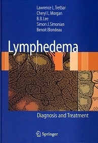 Lymphedema "Diagnosis And Treatment"
