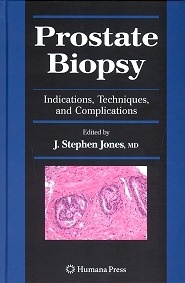 Prostate Biopsy "Indications, Techniques and Complications"