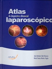 Atlas de Diagnóstico Diferencial Laparoscópico