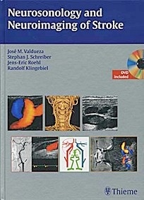 Neurosonology and Neuroimaging of Stroke, Book & DVD