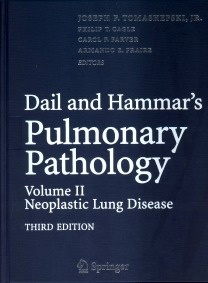 Dail & Hammar's. Pulmonary Pathology  Vol. 2