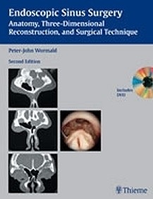 Endoscopic Sinus Surgery + Dvd