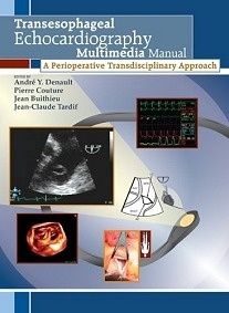 Transesophageal Echocardiography multimedia Manual : A Perioperative Transdisciplinary Approach