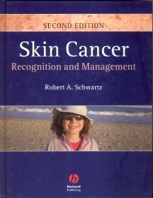 Skin Cancer "Recognition and Management"
