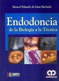 Endodoncia de la Biologia a la Técnica