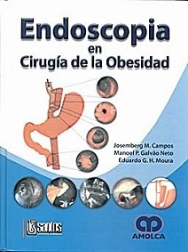 Endoscopia en Cirugia de la Obesidad