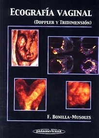 Ecografia Vaginal. "Doppler y Tridimension"
