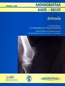 Artrosis "Monografias AAOS - SECOT"