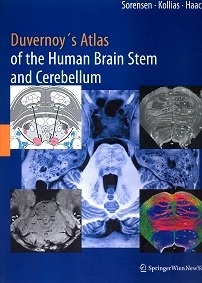 Duvernoy s Atlas of the Brain Stem and Cerebellum