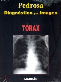 Diagnostico por Imagen. Torax Flexilibro Vol. 1