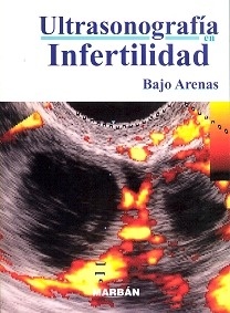 Ultrasonografía en Infertilidad