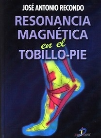 Resonancia Magnetica en el Tobillo-Pie