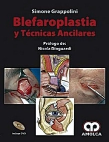 Blefaroplastia y Tecnicas Ancilares + Dvd