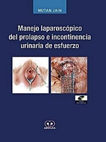 Manejo Laparoscopico del Prolapso e Incontinencia Urinaria de Esfuerzo + Dvd