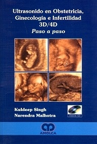 Ultrasonido en Obstetricia, Ginecología e Infertilidad 3d/4d "Paso a Paso"