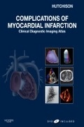 Complications of Myocardial Infarction. With DVD "Clinical Diagnostic Imaging Atlas"