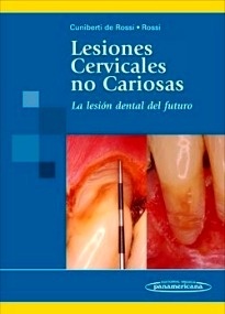 Lesiones Cervicales no Cariosas "La lesión dental del futuro"