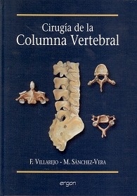 Cirugía de la Columna Vertebral