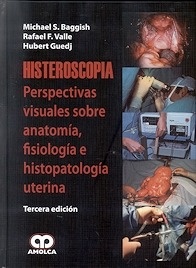 Histeroscopia. Persperctivas Visuales Sobre Anatomía, Fisiología e Histopatología Uterina
