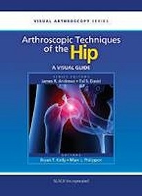 Arthroscopic Techniques of the Hip "A Visual Guide"