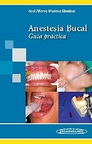 Anestesia Bucal "Guía práctica"