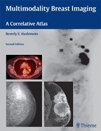 Multimodality Breast Imaging "A Correlative Atlas"