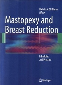 Mastopexy and Breast Reduction "Principles and Practice"