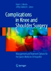 Complications in Knee and Shoulder Surgery "Management and Treatment Options for the Sports Medicine Orthope"