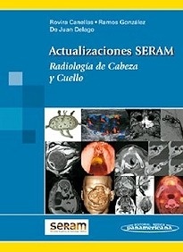 Actualizaciones SERAM: Radiología de Cabeza y Cuello