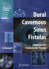 Dural Cavernous Sinus Fistulas "Diagnosis and Endovascular Therapy"