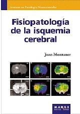 Fisiopatología de la Isquemia Cerebral