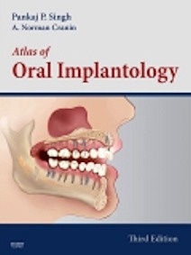 Atlas Of Oral Implantology