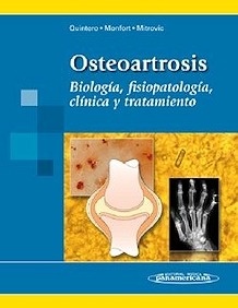 Osteoartrosis "Biología, Fisiopatología, Clínica y Tratamiento"