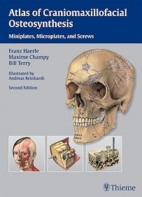 Atlas Of Craniomaxillofacial Osteosynthesis "Microplates, Miniplates, And Screws"