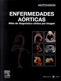 Enfermedades Aórticas + DVD-ROM