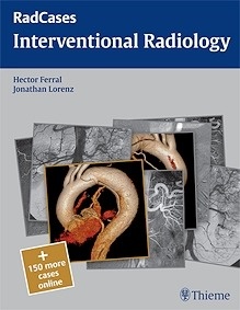 Interventional Radiology. Radcases