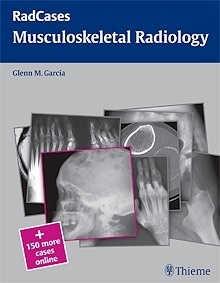 Musculoskeletal Radiology. Radcases