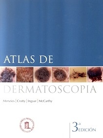 Atlas de Dermatoscópia